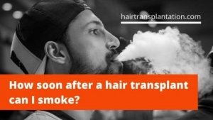 How soon after a hair transplant can you wear a hat_ (2)